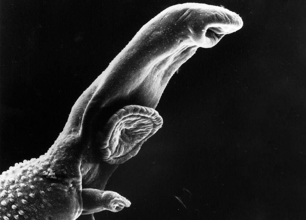 Schistosoma ist ein Parasit, dessen Lebenszyklus einen Zwischenwirt erfordert. 