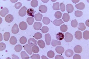 Malaria plasmodium
