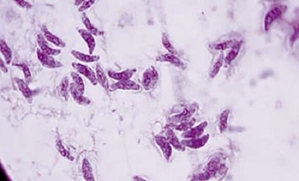Protozoenparasit Toxoplasma gondii der Erreger der Toxoplasmose