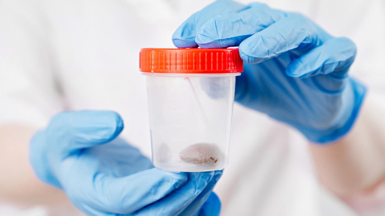 Der einfachste Test, der das Vorhandensein von Würmern anzeigt, ist die Analyse von Kot
