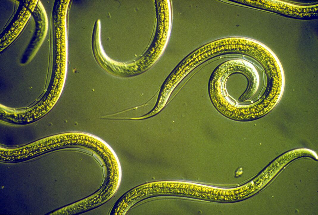 Madenwürmer aus dem menschlichen Körper