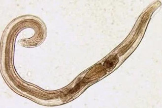 Parasiten des Menschen Madenwürmer